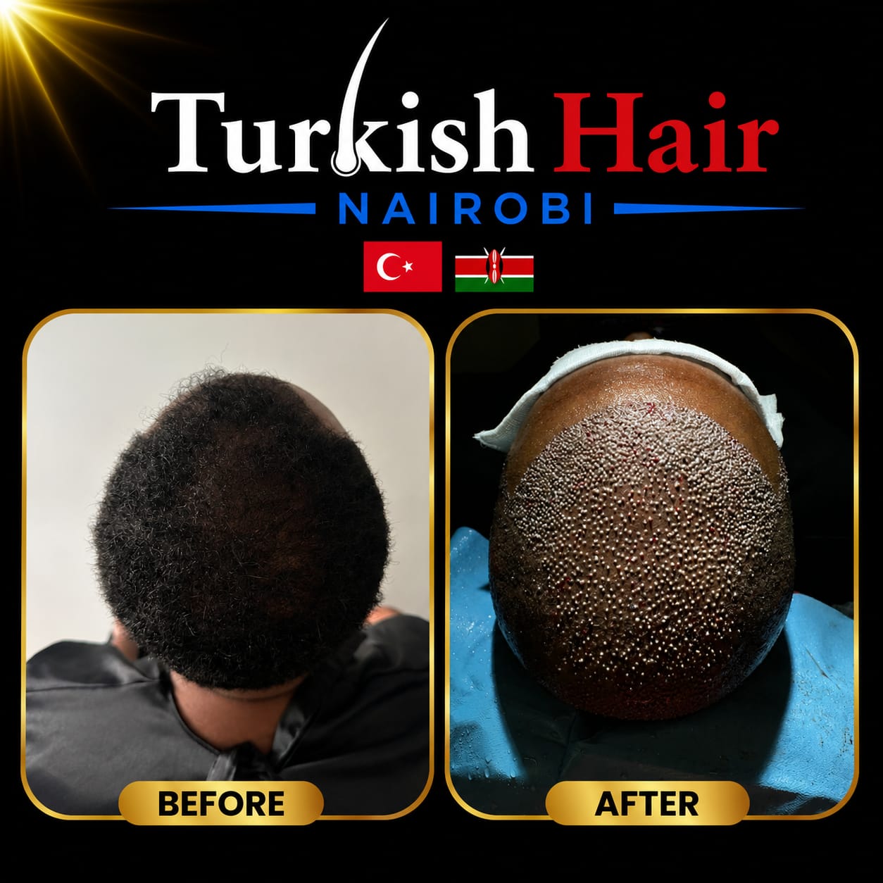 Turkish Hair Nairobi Case 7